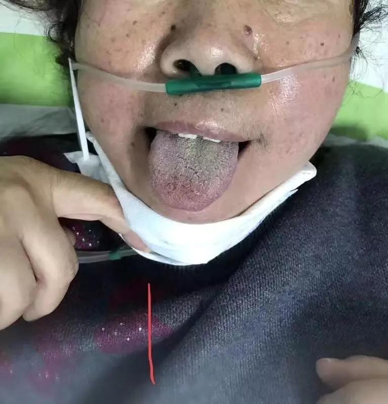 新加坡新冠肺炎最新動態(tài)更新??